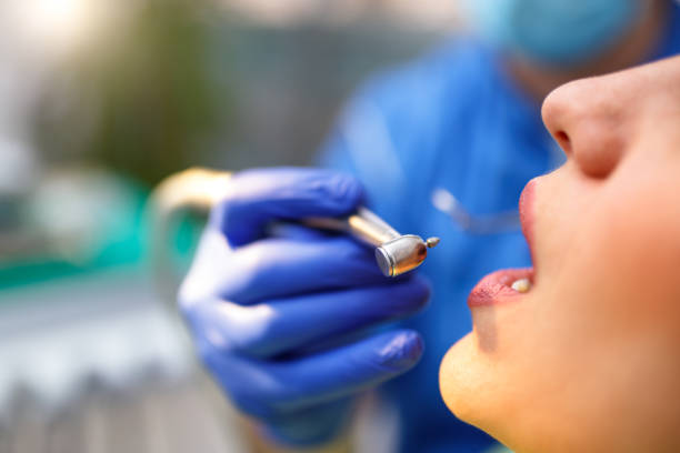 Best Dental Fillings (Composite and Amalgam)  in Markle, IN